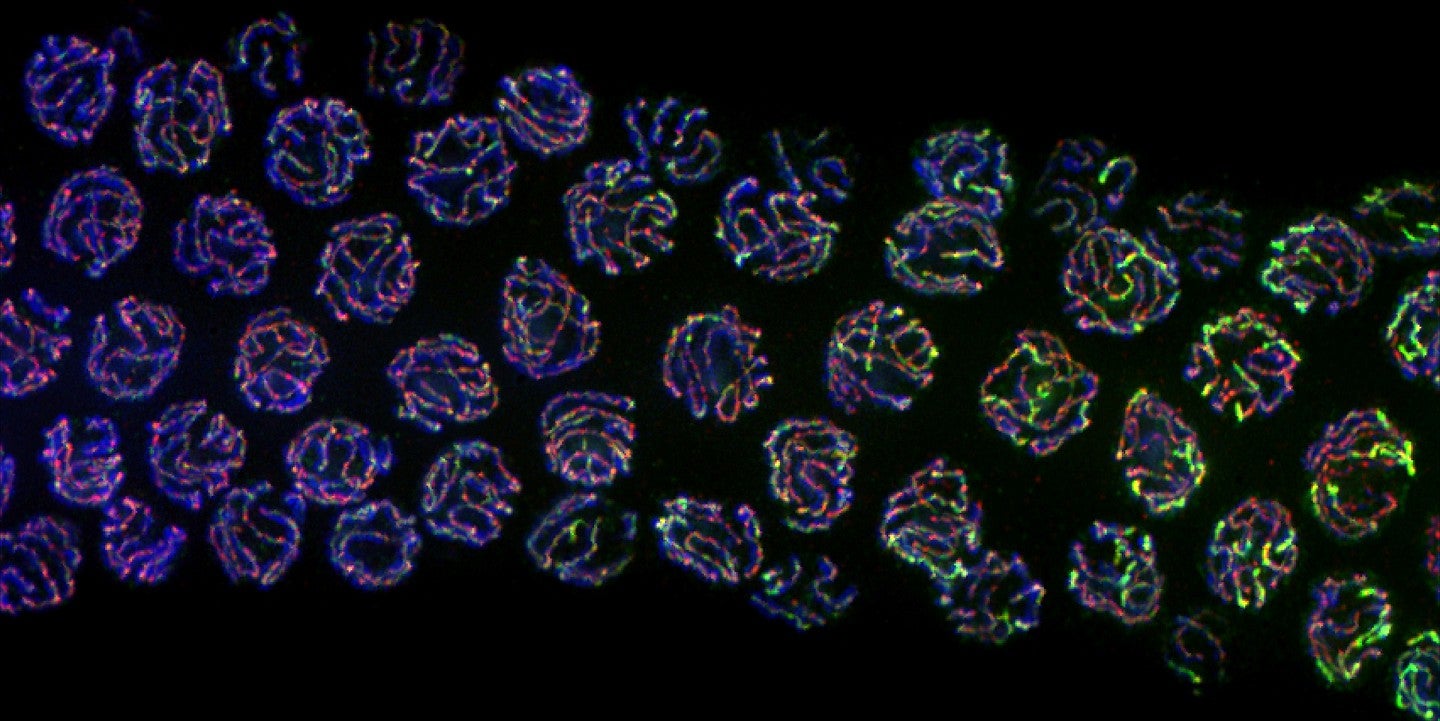 Microscope image of chromosomes highlighted in fluorescent colors