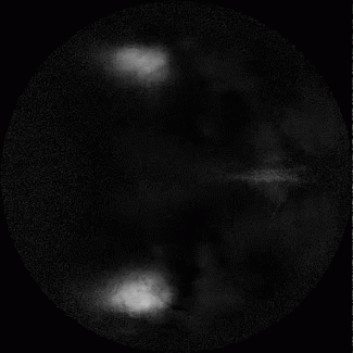 Widefield calcium imaging show normal neural activity across wide regions of the brain in response to a stimulus