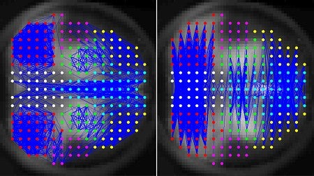 Brain scan image