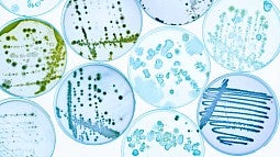 Cultures growing in petri dishes
