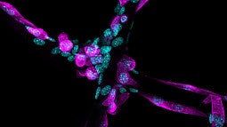 Microscope image of cells attaching to a scaffold