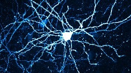 Cortical neuron micrograph