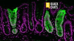 Colon and related stem cells, colored in green, help Zemper track the cells in mice