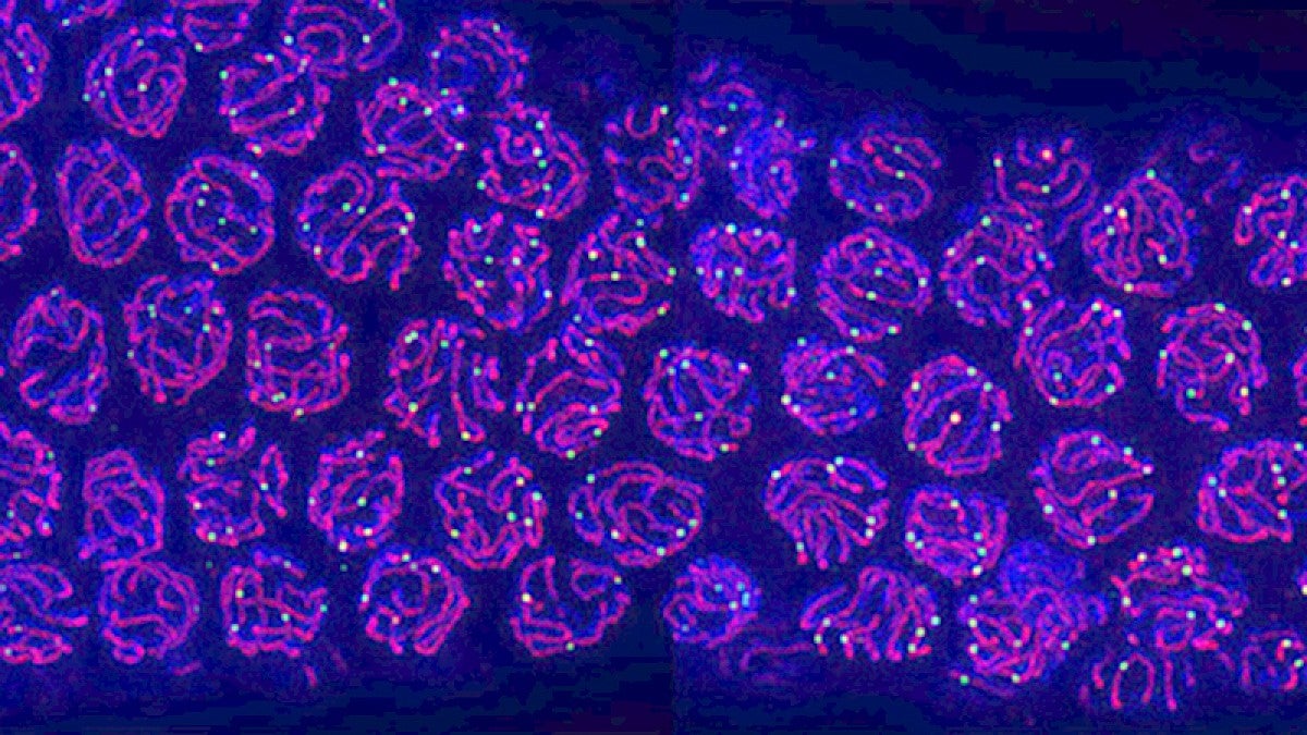 Microscopic image of eggs developing inside a worm