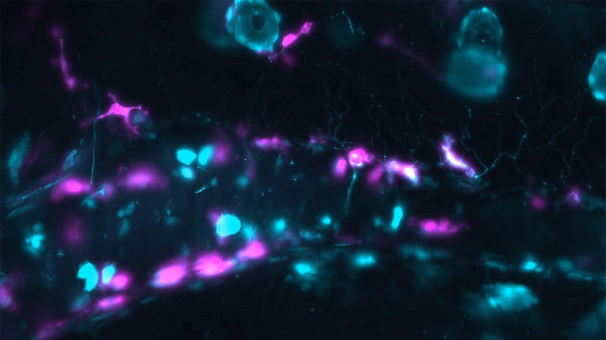 Gut cells of a zebrafish highlighted in blue and magenta