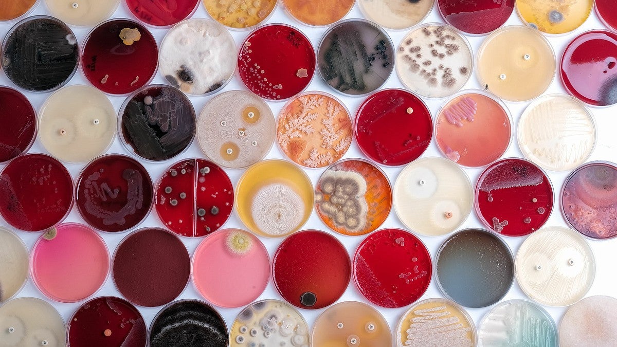 Cultures in multicolored petri dishes