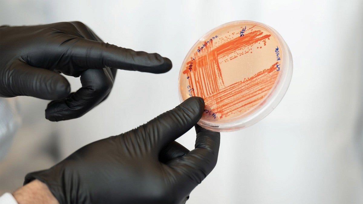 Researcher holding petri dish with bactria culture