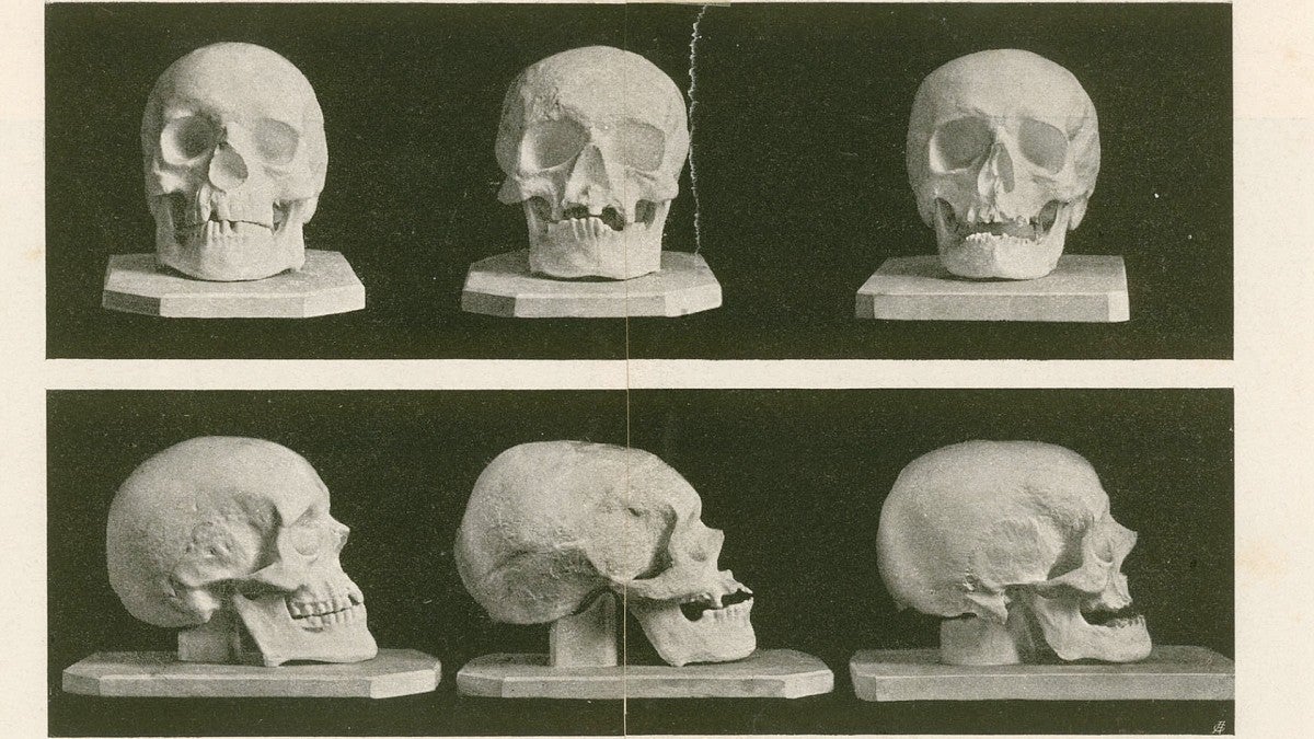 Casts of the skulls of Schubert, Haydn and Beethoven