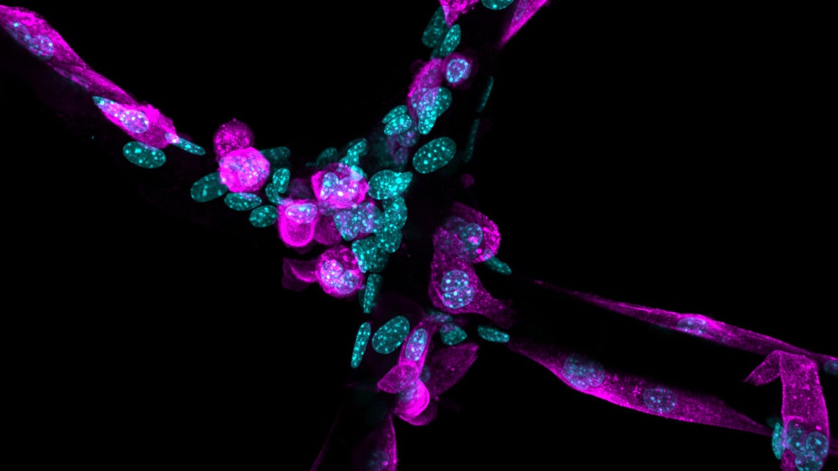 Microscope image of cells attaching to a scaffold