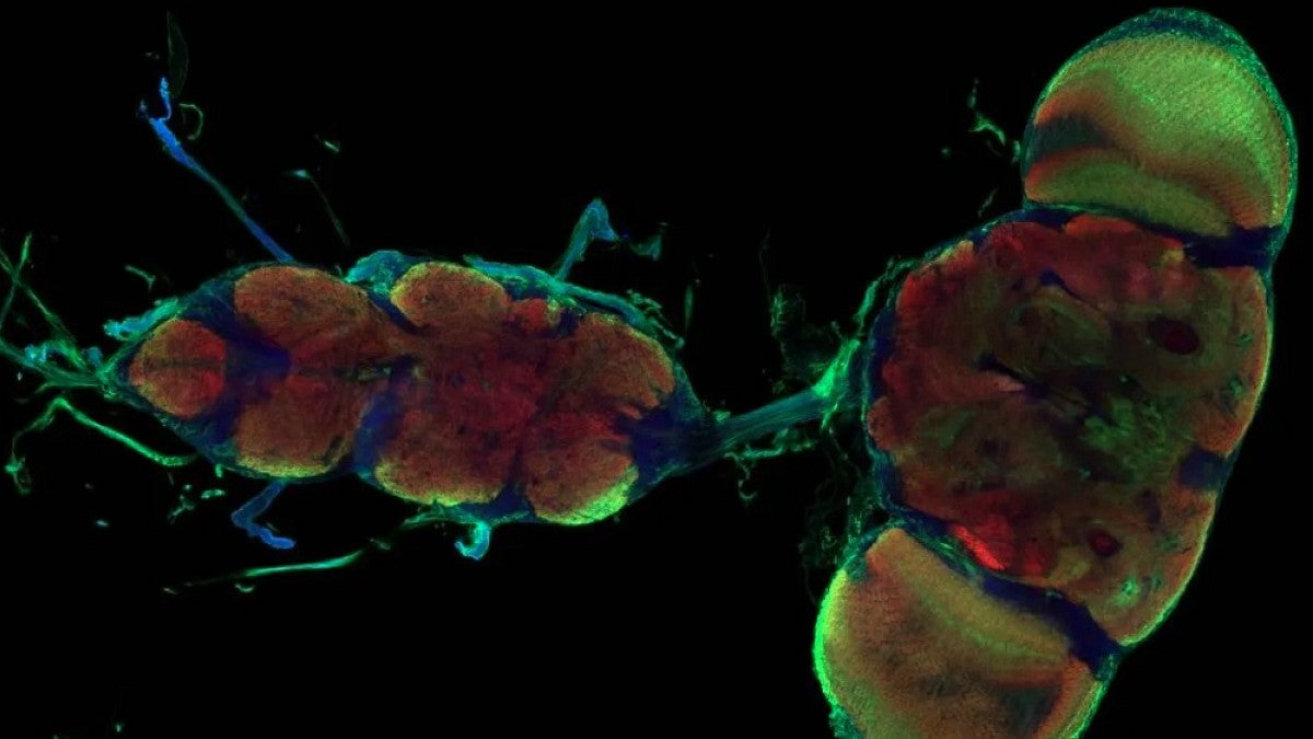 Microscopic image of fruit fly brain