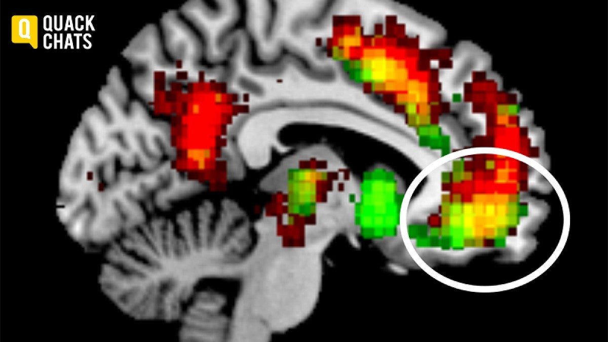 Parts of the brain linked to forming habits