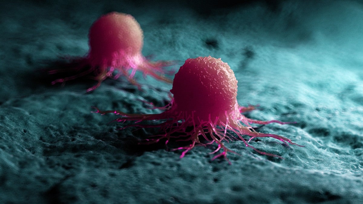 Illustration of cancer cells