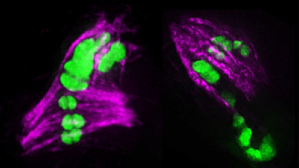 Chromosomes in a developing egg