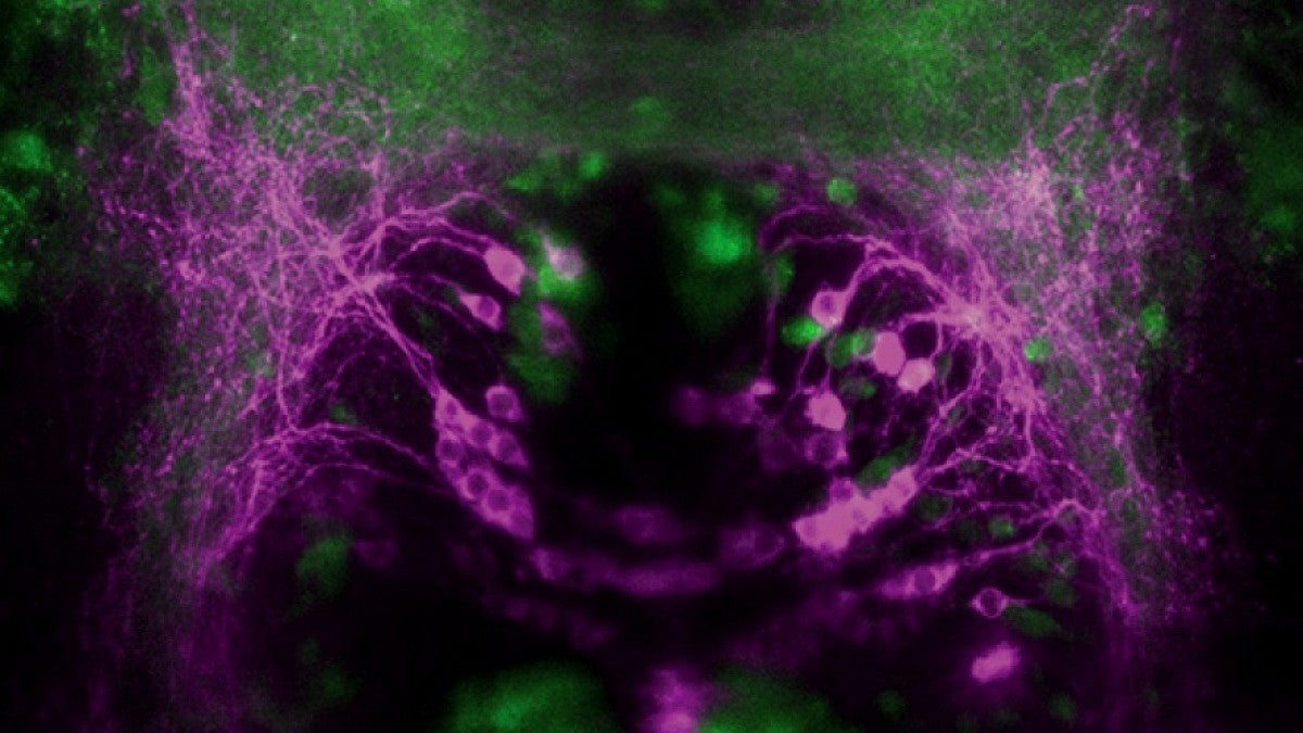 Neurons stained magenta and green