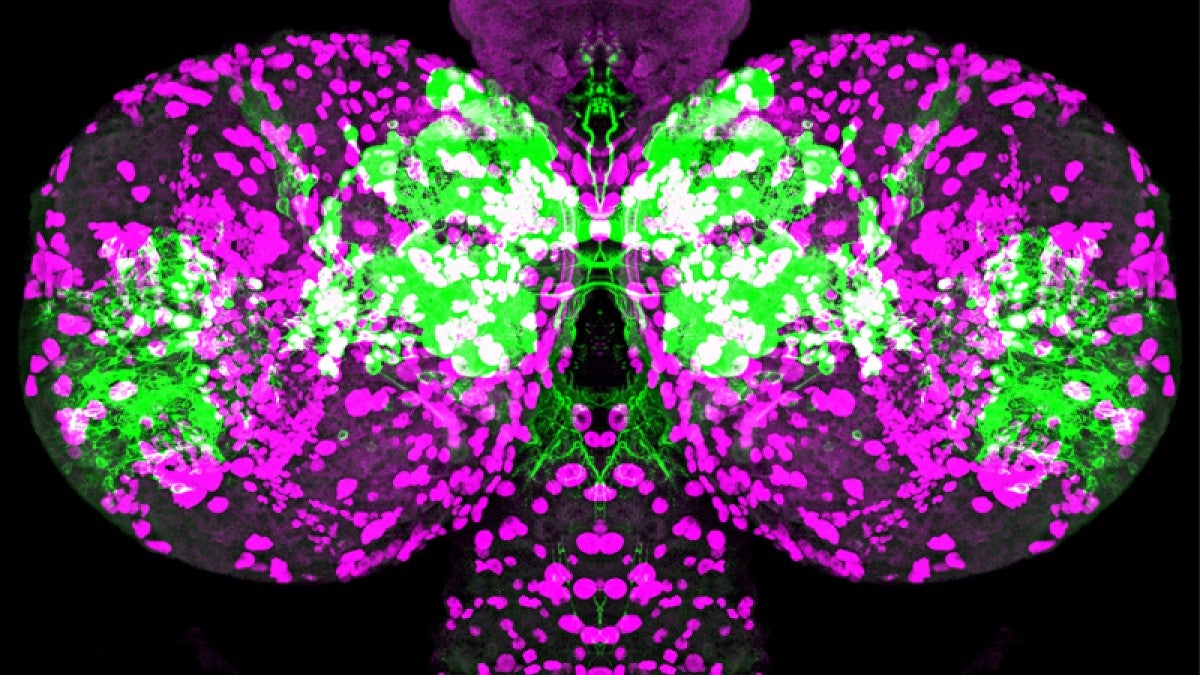 Image shows the over-production of unnecessary cells when a key hormone is blocked during brain development in a fruit fly