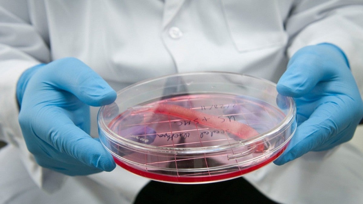 Researcher holding culture dish