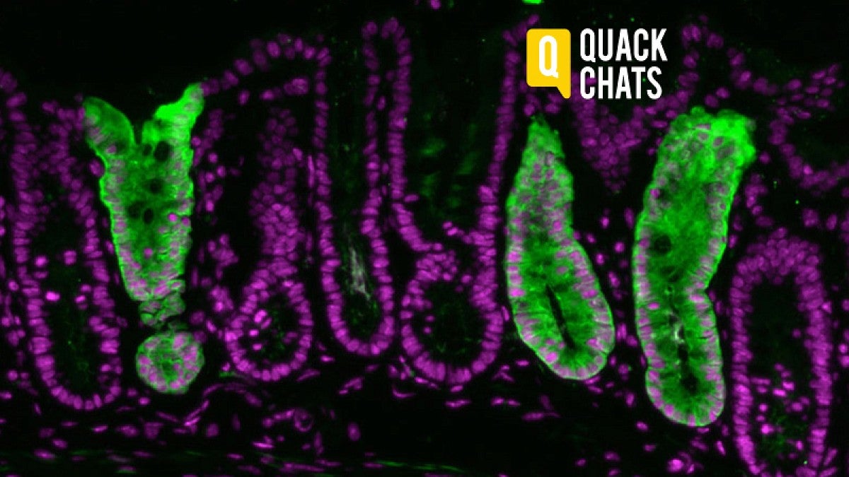 Colon and related stem cells, colored in green, help Zemper track the cells in mice
