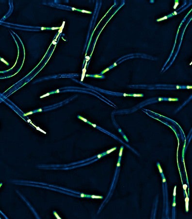 Worms glowing blue and green under a microscope