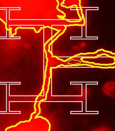 Retinal neuron branching out and attaching to a fractal implant