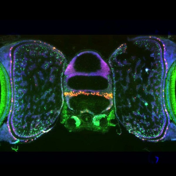 Image of the optical lobe of an octopus